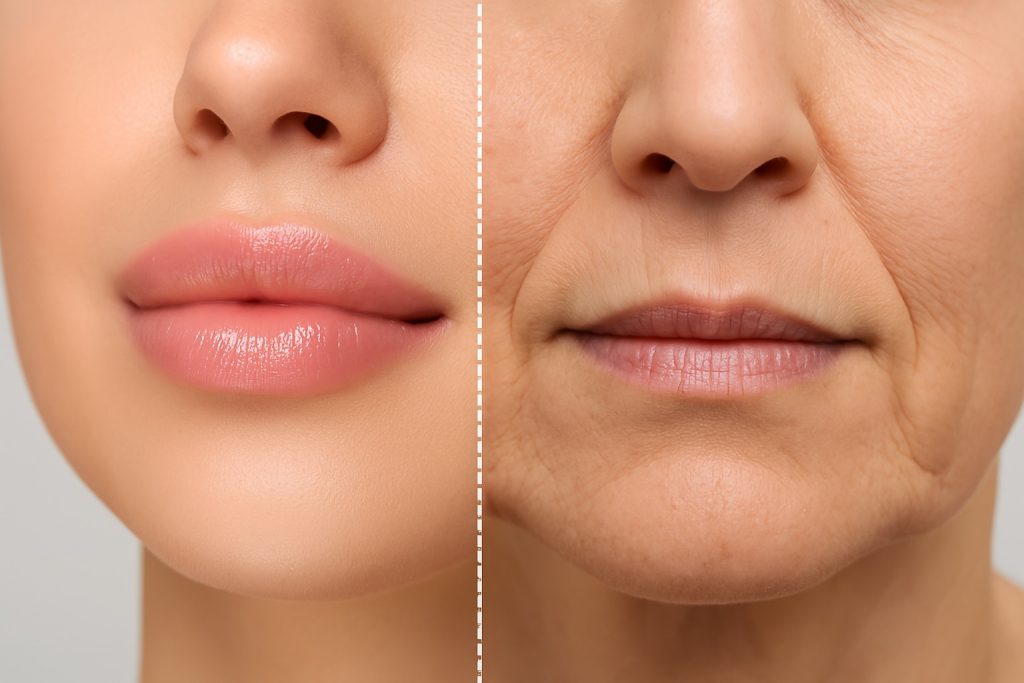 Hieu qua plasma so sánh plasma fibroblast và co2 laser môi - Hieu qua plasma